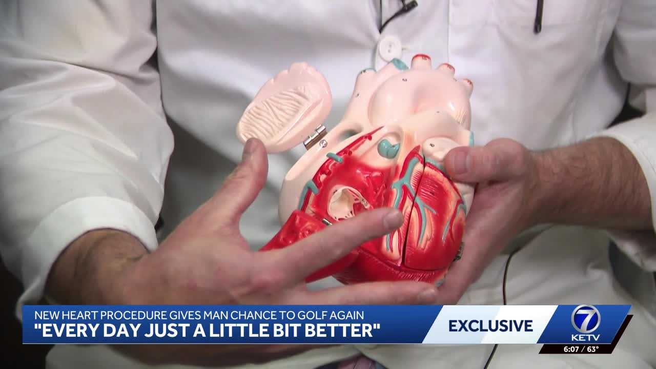 New heart procedure helps man swing a golf club again — WISN 12 Milwaukee, Lincoln Community news